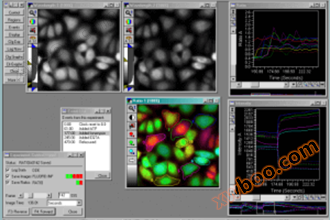 MetaMorph advanced image analysis software